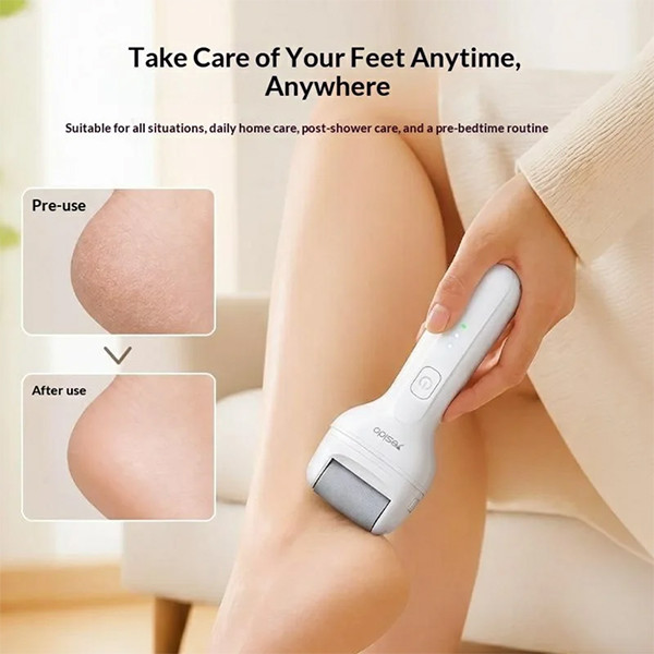 Yesido MG35 Callus Remover Skin Safe - mobile shop in Hamra, Beirut, Lebanon. New and used phones, iPhone, Samsung, Huawei, Xiaomi, Oppo, Realme, Honor, Google Pixel, tablets, laptops, computers, and accessories. متجر موبايلات في الحمرا، بيروت، لبنان. هواتف جديدة ومستعملة، آيفون، سامسونج، هواوي، شاومي، أوبو، ريلمي، هونر، جوجل بيكسل، أجهزة لوحية، لابتوبات، كمبيوترات، واكسسوارات.